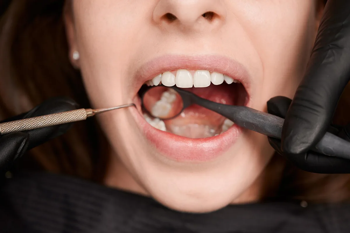 How to Maintain Healthy Teeth: 5 Key Rules from Veda Stom